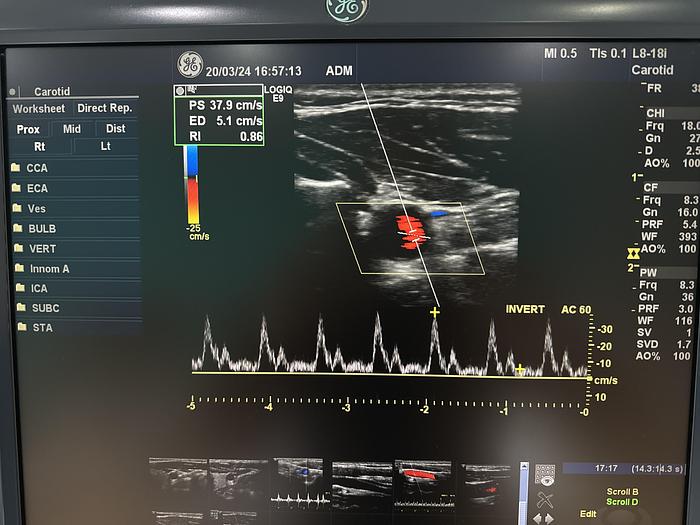 Gebraucht GE L8-18i-D Linear Ultraschallsonde