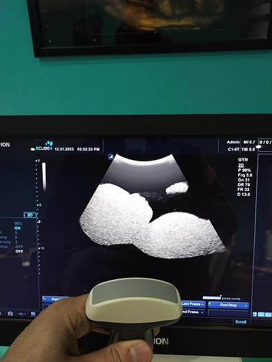 Gebraucht Alpinion ECUBE 5 Flachbildschirm-Ultraschallgerät inkl. 2 sonden Ultrasound