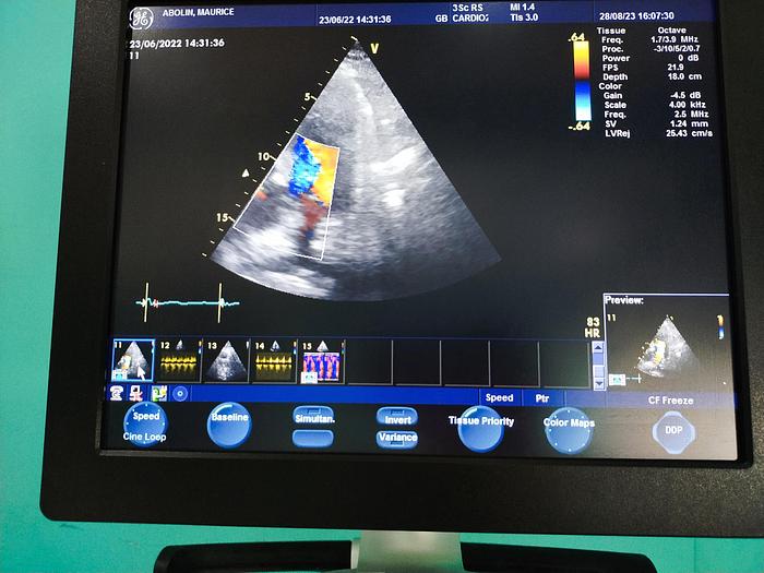 Gebraucht GE Vivid S5 Ultraschallgerät
