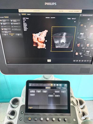 Gebraucht Philips V6-2  3D/4D  Volumen Ultraschallsonde