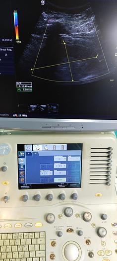 Gebraucht GE Logiq 7 Ultraschallgerät mit 2 Sonden, DVD Laufwerk und Drucker