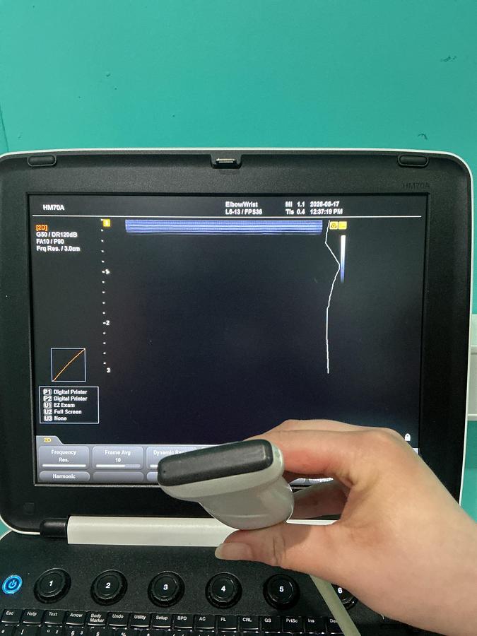 Gebraucht Samsung Medison HM7AF1B Ultraschallgerät mit zwei Sonden