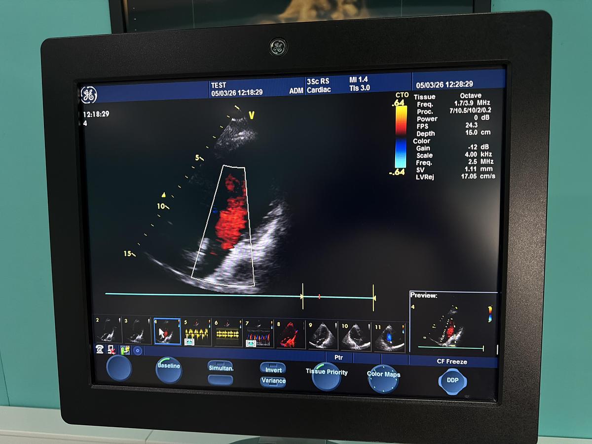 Gebraucht GE Vivid S6 Ultraschallgerät mit 3Sc-RS kardio Sonde
