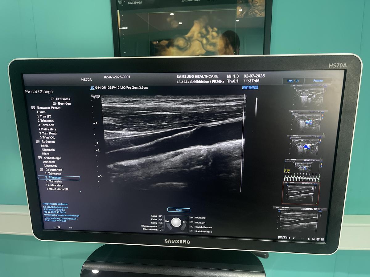 Gebraucht Samsung HS70A Ultraschallgerät mit drei Sonden