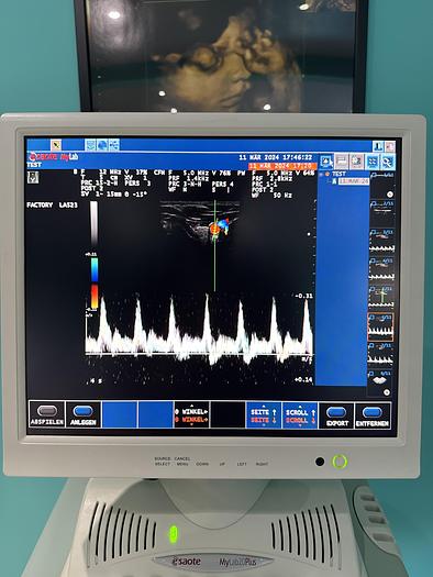 Gebraucht Esaote MyLab20Plus Ultraschallgerät mit drei Sonden