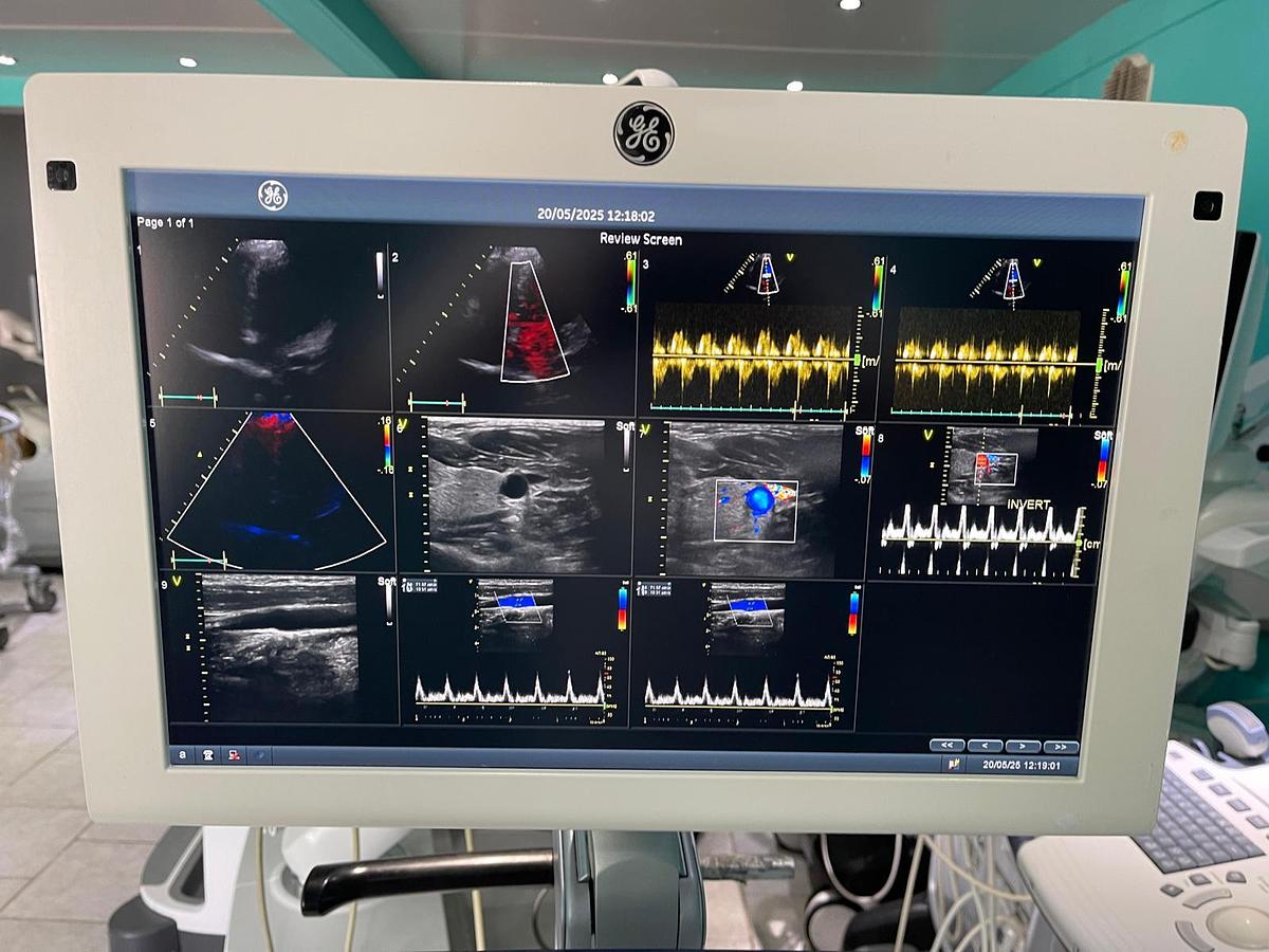 Gebraucht GE Vivid S70 Ultraschallgerät mit zwei Sonden 
