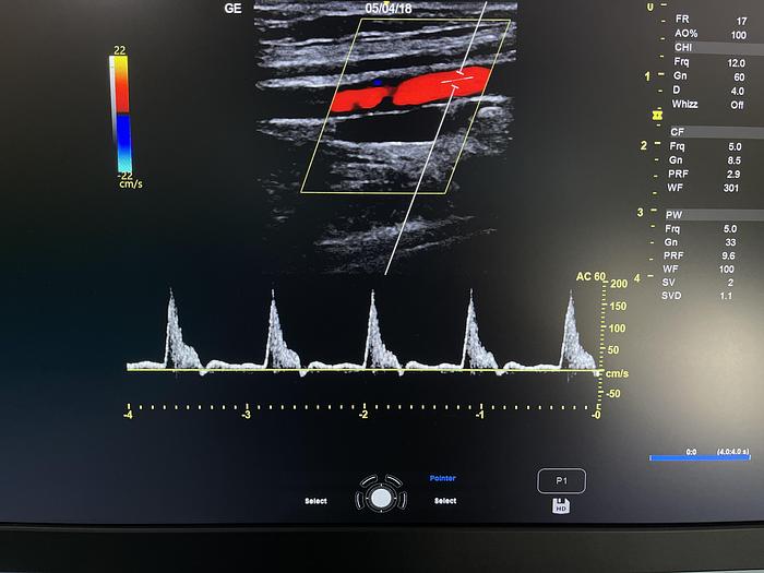 Gebraucht GE Versana Premier Ultraschallgerät mit drei Sonden