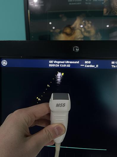 Gebraucht GE Healthcare Vivid E9 Ultraschall Gerät mit zwei Sonden
