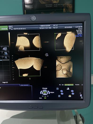 Gebraucht GE 3D/4D RAB4-8-D Ultraschallsonde