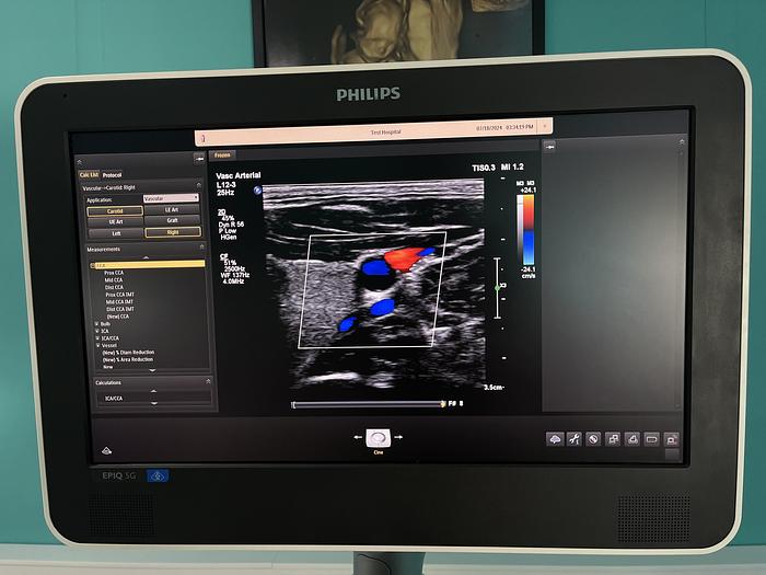 Used Philips EPIQ 5G Ultraschallgerät mit zwei Sonden