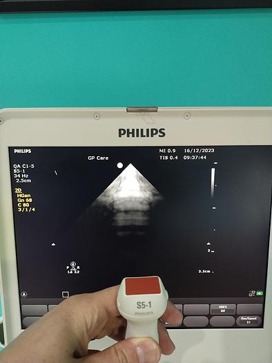 Gebraucht Philips CX50 Ultraschallgerät