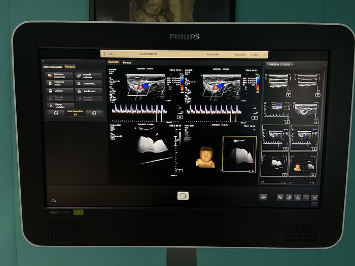 Gebraucht Philips Affiniti 50W Ultraschallgerät mit 3 Sonden und Drucker SV 9.0.5