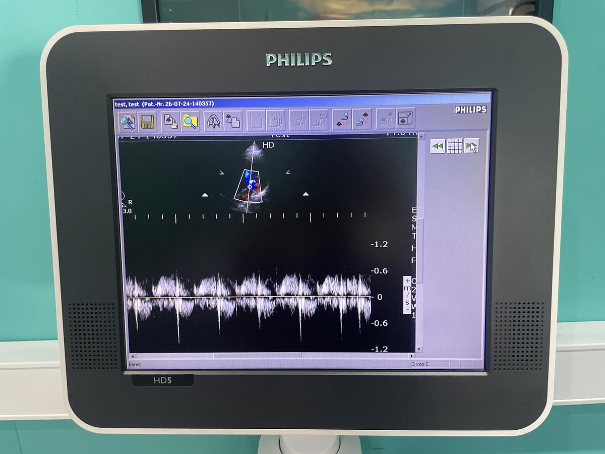 Gebraucht Philips HD5 Ultraschallgerät mit zwei Sonden und Drucker