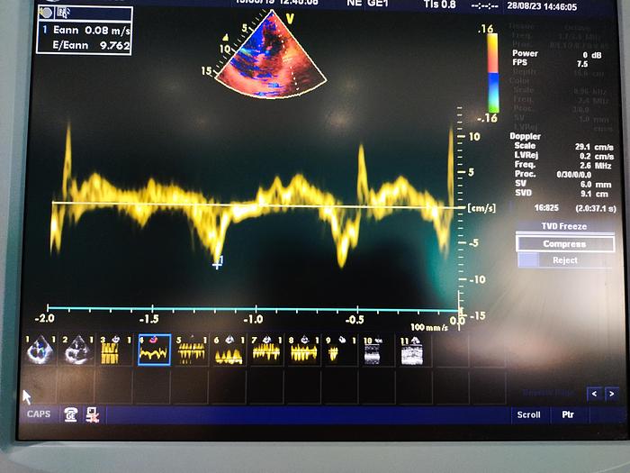 Gebraucht GE Vivid 7 Ultraschallgerät