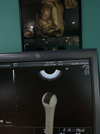 Used GE Voluson E8 Ultraschallgerät mit zwei Sonden und Drucker