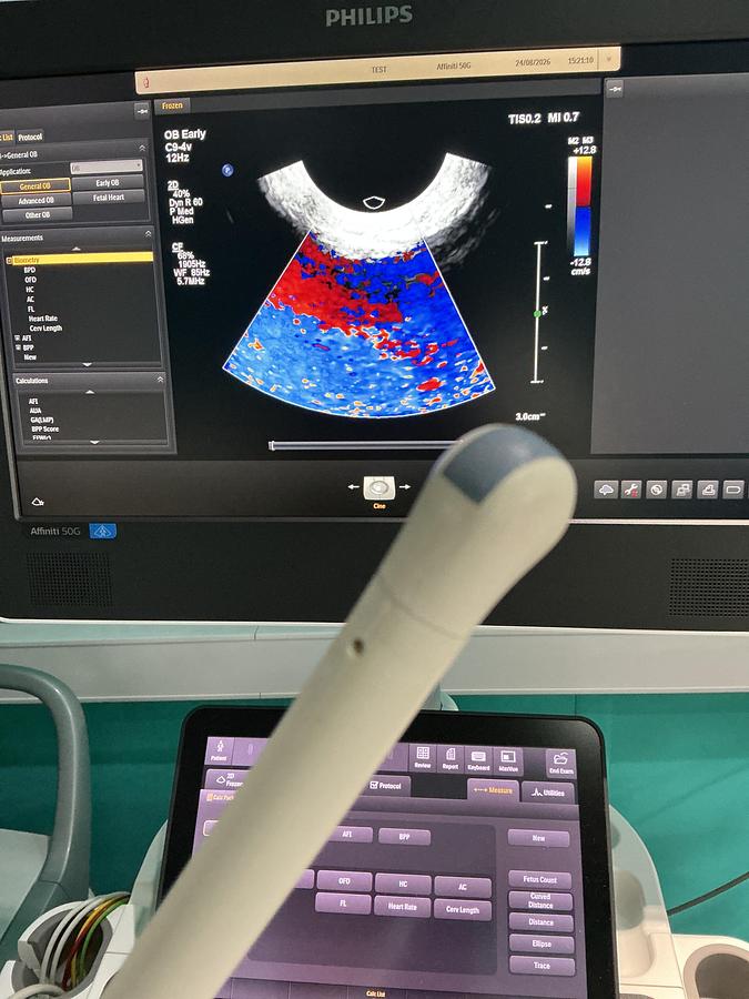 Gebraucht Philips C9-4V Endovaginal Ultraschallsonde