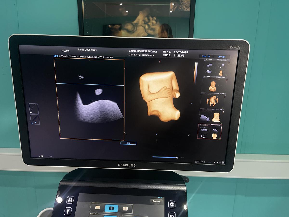 Gebraucht Samsung HS70A Ultraschallgerät mit drei Sonden