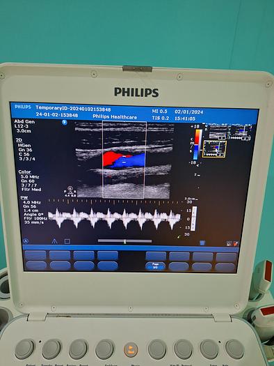 Gebraucht Philips CX50 Ultraschallgerät