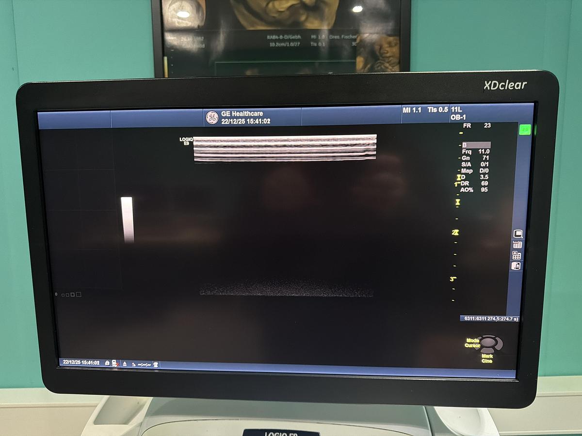 Gebraucht GE LOGIQ E9 XDClear Elastography Ultraschallgerät mit zwei Sonden  