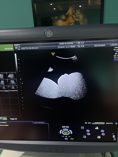 Gebraucht GE 3D/4D RAB4-8-D Ultraschallsonde