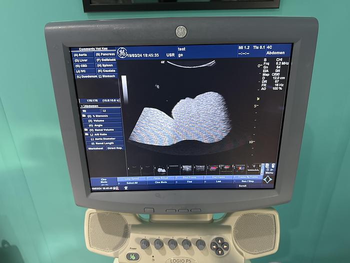 Gebraucht GE Logiq P5 Ultraschallgerät mit drei Sonden und Drucker