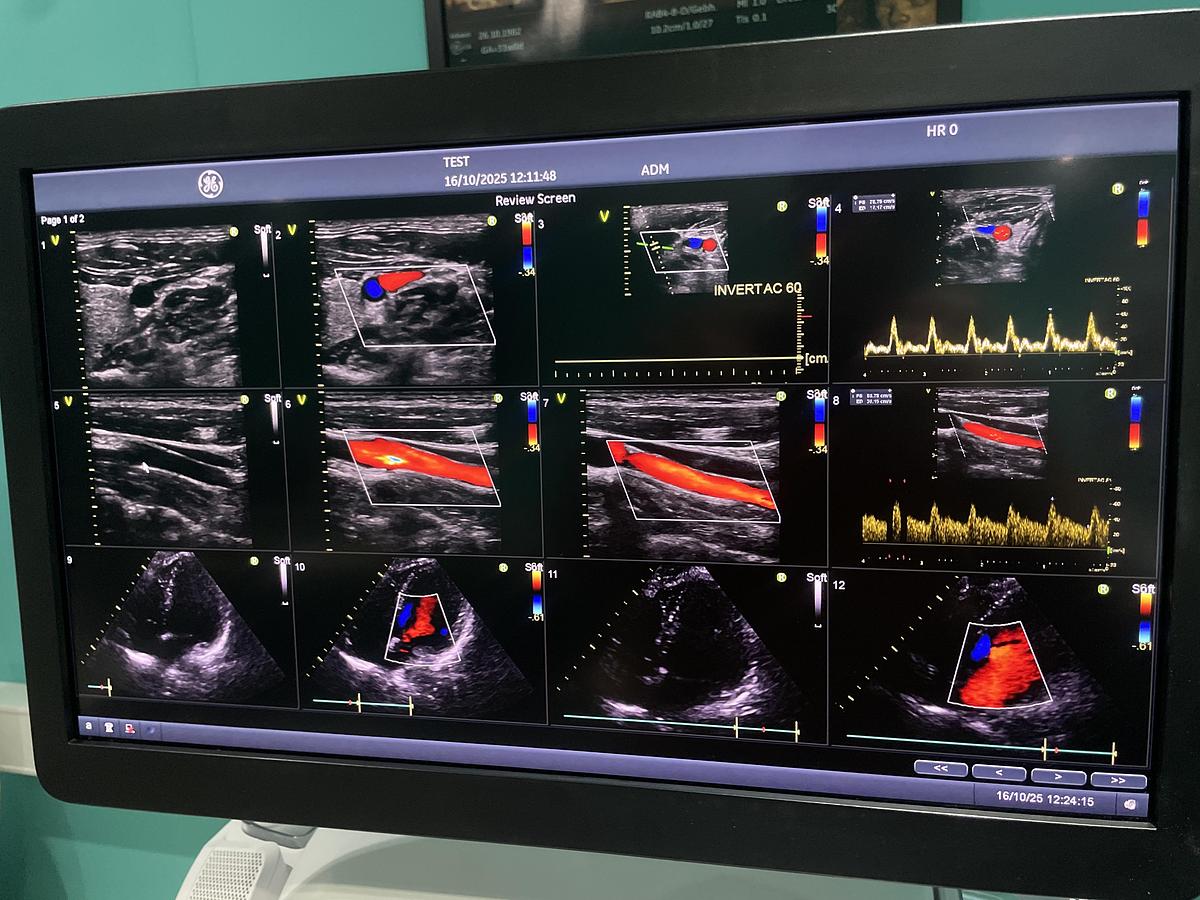 Gebraucht GE Vivid E95 v202 Ultraschallgerät mit zwei Sonden