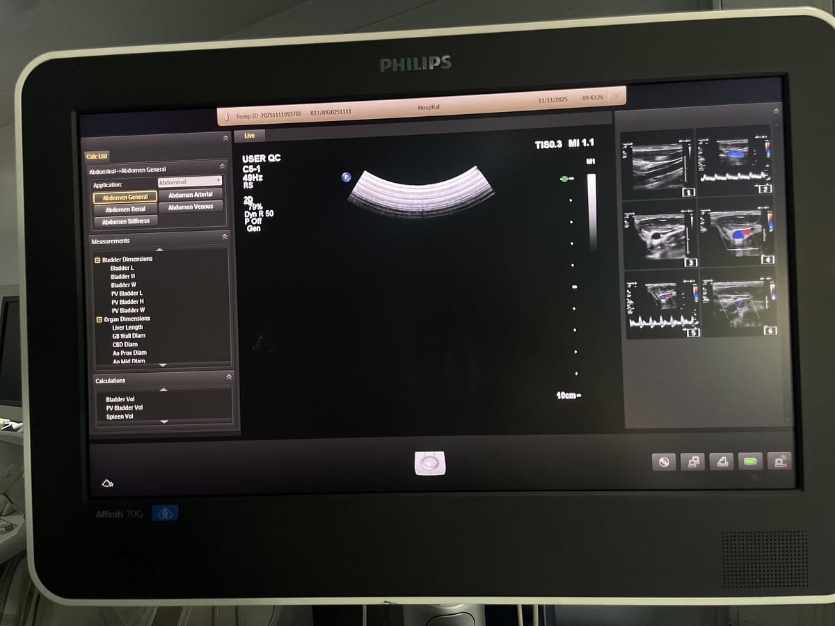 Gebraucht Philips C5-1 Konvex PureWave Ultraschallsonde