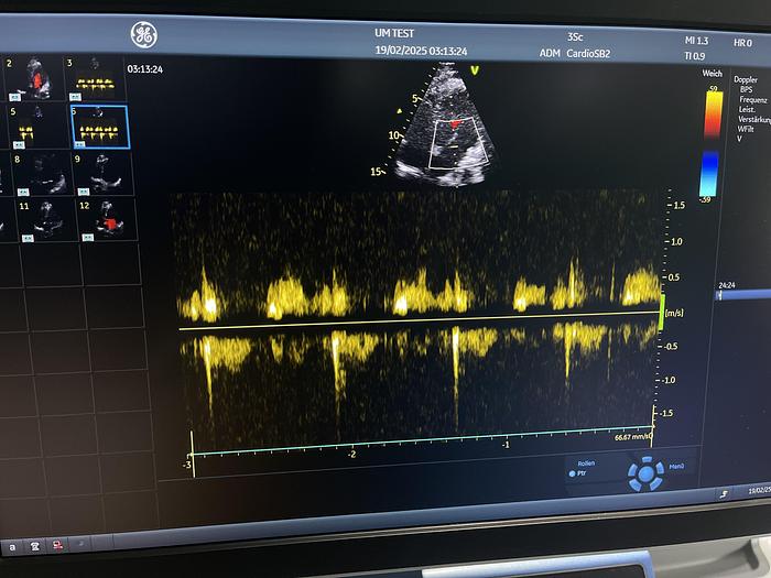 Gebraucht GE 3SC-RS Sektor Ultraschallsonde 