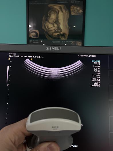 Gebraucht HELX Evoulution Acusion S2000 von Siemens Ultraschall Gerät mit drei Sonden