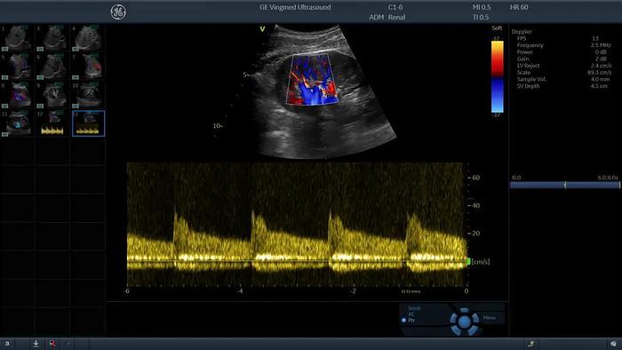 GE Vivid S70N Ultra Edition überholtes Ultraschallsystem