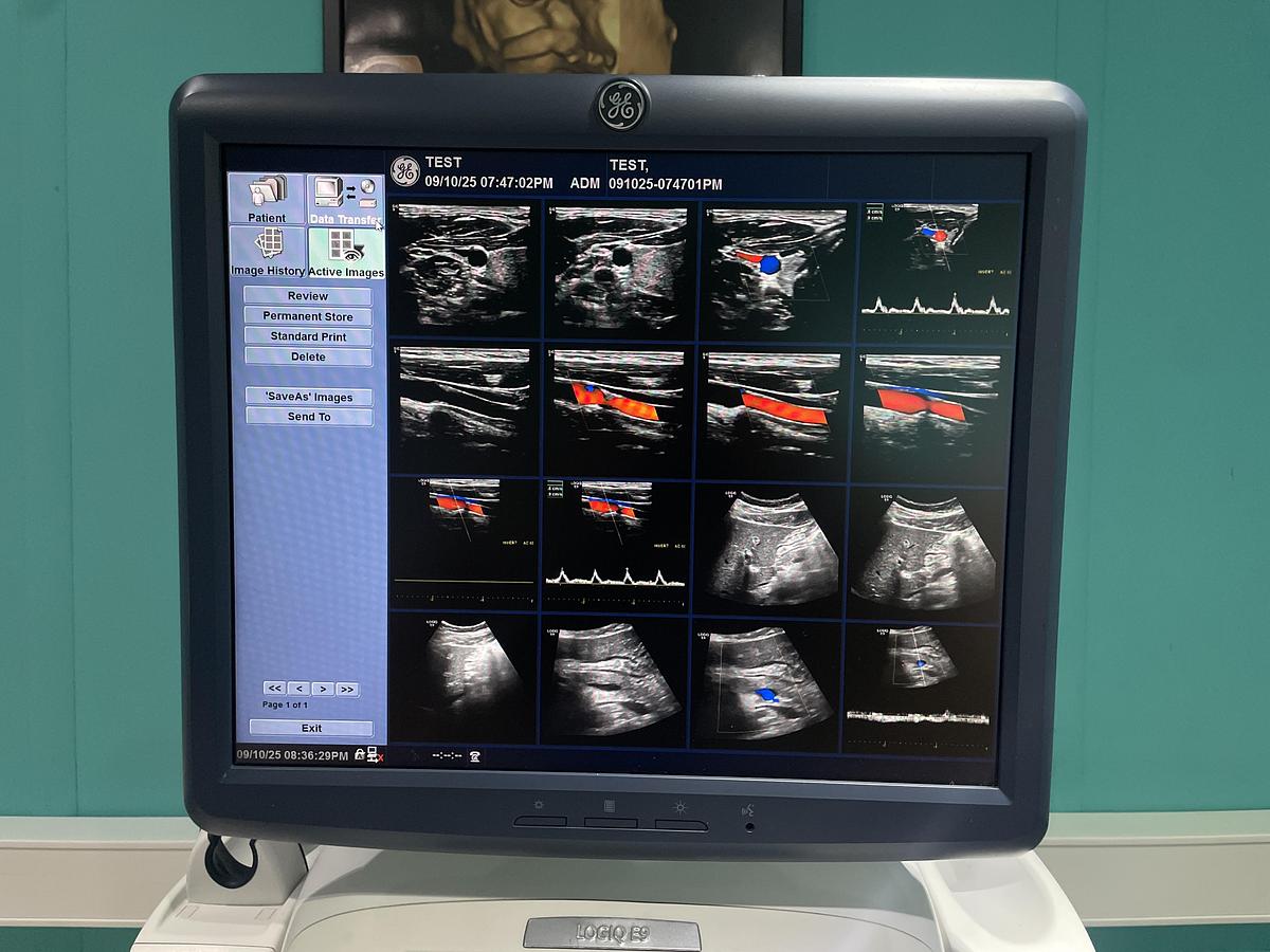 Gebraucht GE LOGIQ E9 Ultraschallgerät mit 2 Sonden und Drucker