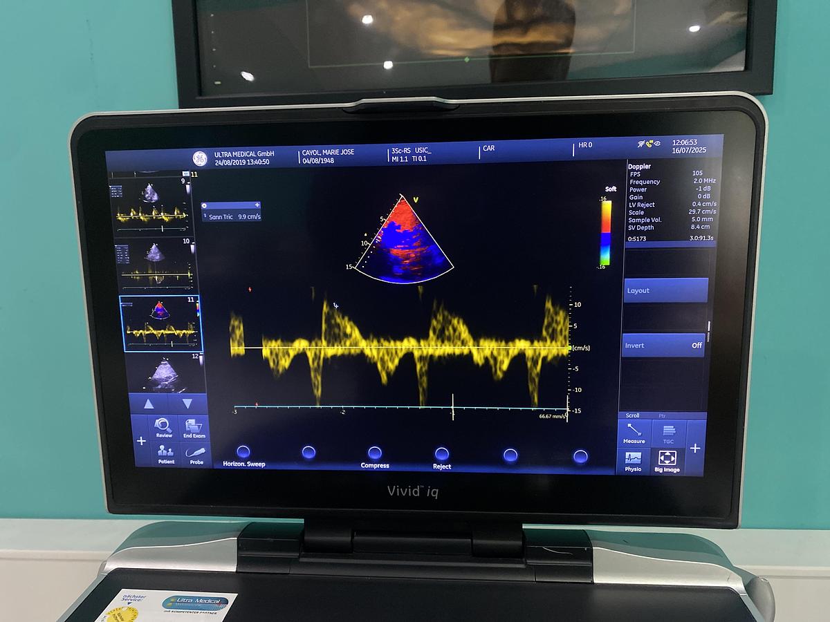 Gebraucht GE Vivid iq Ultraschallgerät mit M5Sc-RS Kardiosonde