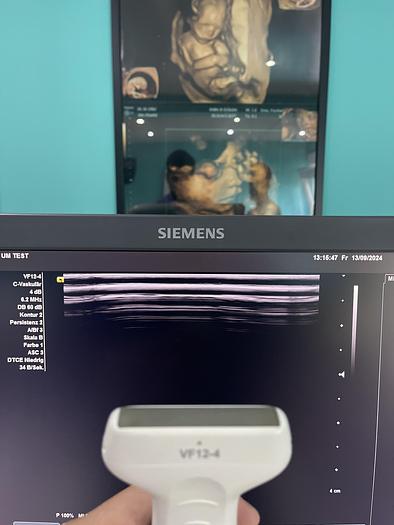 Used Siemens Acuson X600 Ultraschallgerät mit drei Sonden