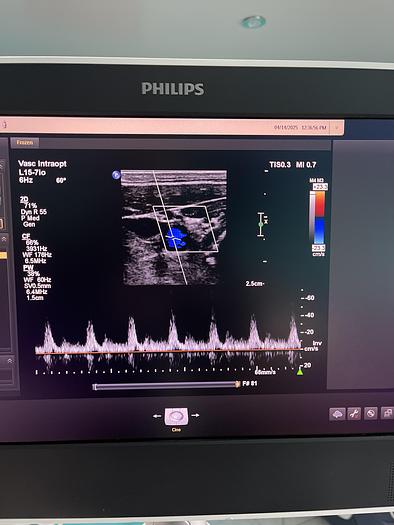 Gebraucht Philips L15-7io Linear Ultraschallsonde
