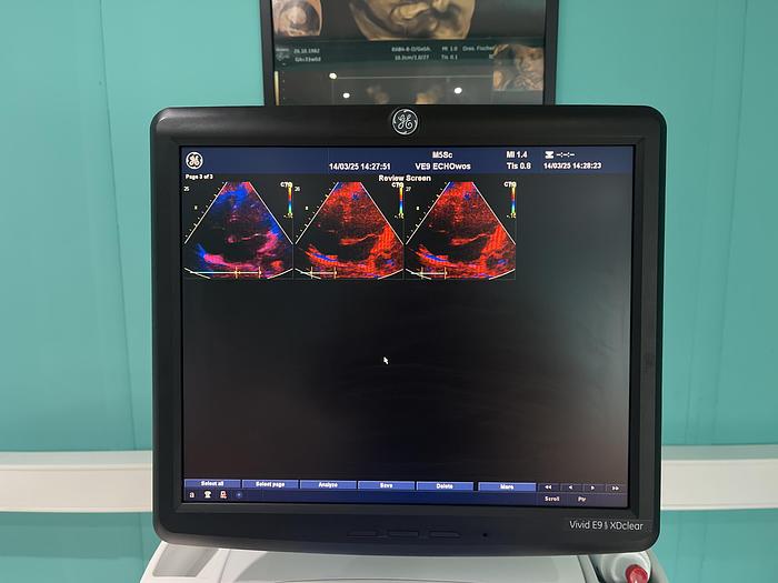 Gebraucht GE Vivid E9 XDclear Ultraschallgerät mit zwei Sonden #2015 