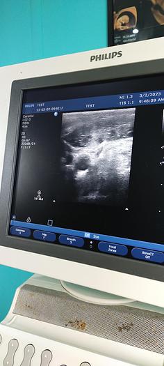 Gebraucht Philips HD11XE Ultraschallgerät mit 3 Sonde