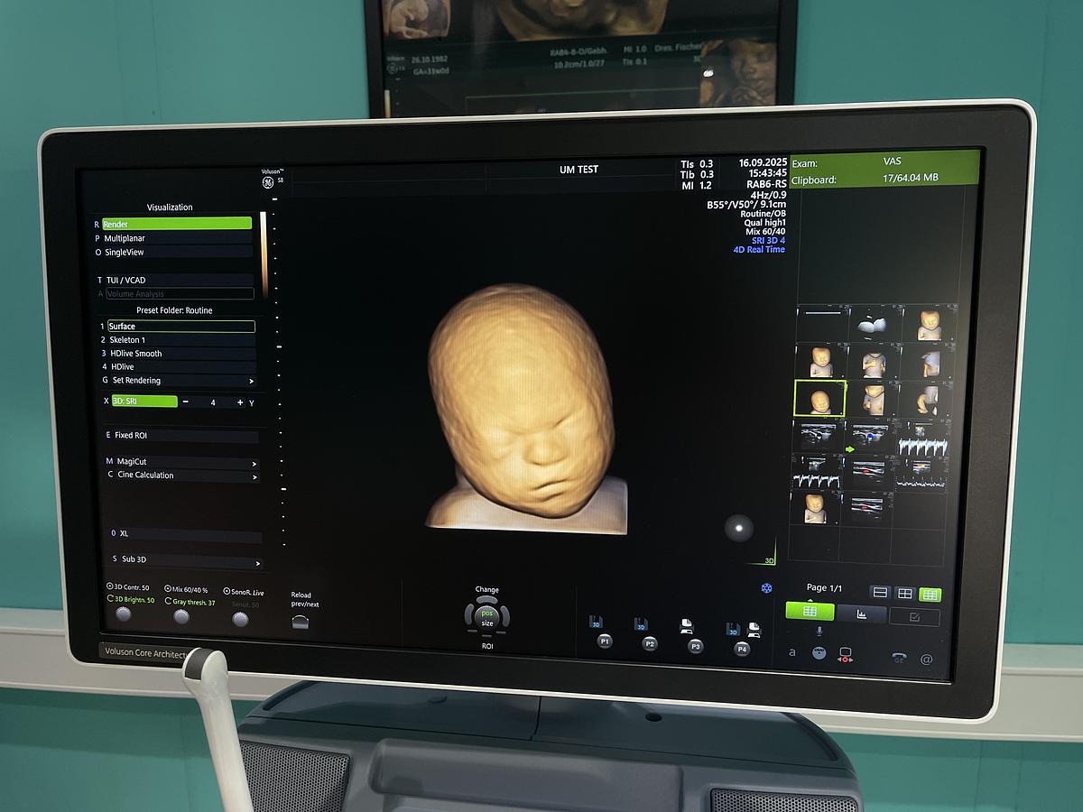 Gebraucht GE Voluson S8 Ultraschallgerät mit drei Sonden und Drucker