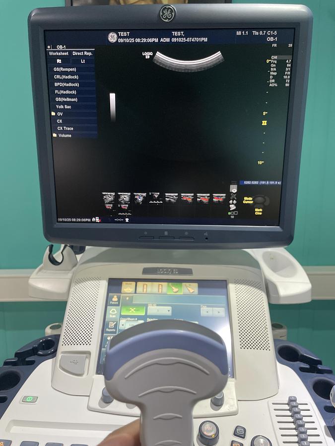 Gebraucht GE LOGIQ E9 Ultraschallgerät mit 2 Sonden und Drucker