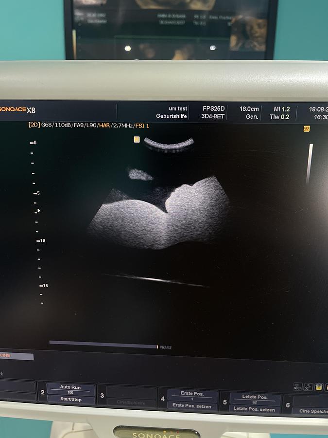 Gebraucht SonoAce X8 Ultraschallgerät mit drei Sonden und Drucker