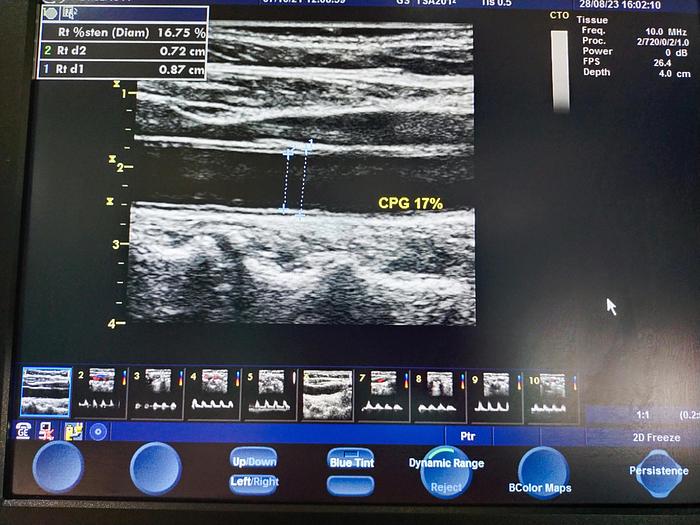 Gebraucht GE Vivid S5 Ultraschallgerät