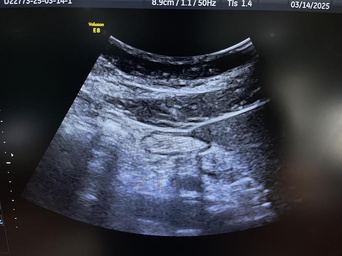 Gebraucht GE C1-5-D konvex Ultraschallsonde