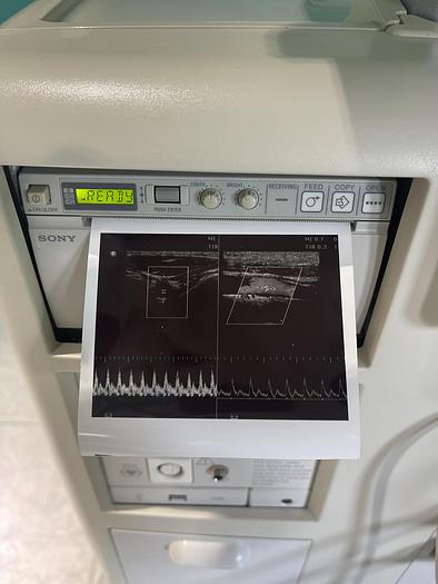 Used Philips HD 11 XE  Ultraschallgerät mit drei Sonden und Drucker