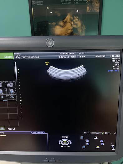 Gebraucht GE 3D/4D RAB4-8-D Ultraschallsonde