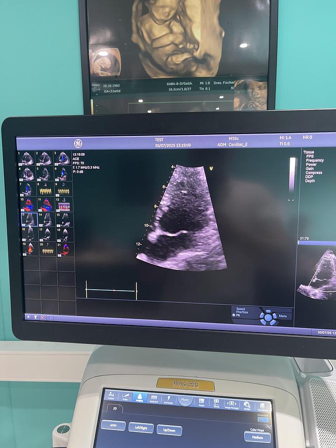 Gebraucht GE Vivid E95 V202 Ultraschallgerät mit M5Sc-D Kardiosonde