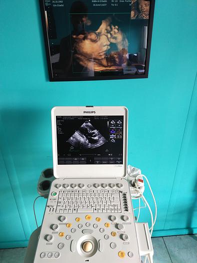 Gebraucht Philips CX50 Ultrasound with S5-1 and Trolly