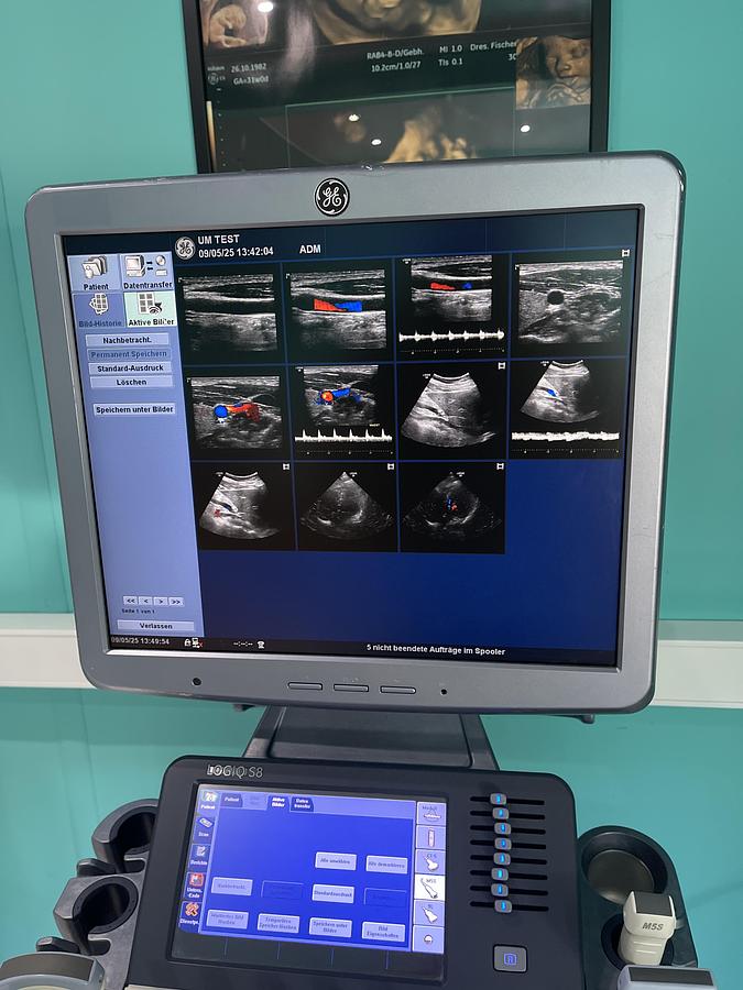 Used GE LOGIQ S8 Ultraschallgerät mit M5S-D kardio Ultraschallsonde und Drucker