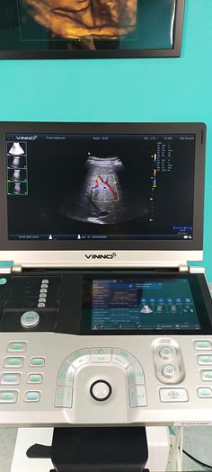 Gebraucht Vinno5 Ultraschallgerät mit 1 Sonde