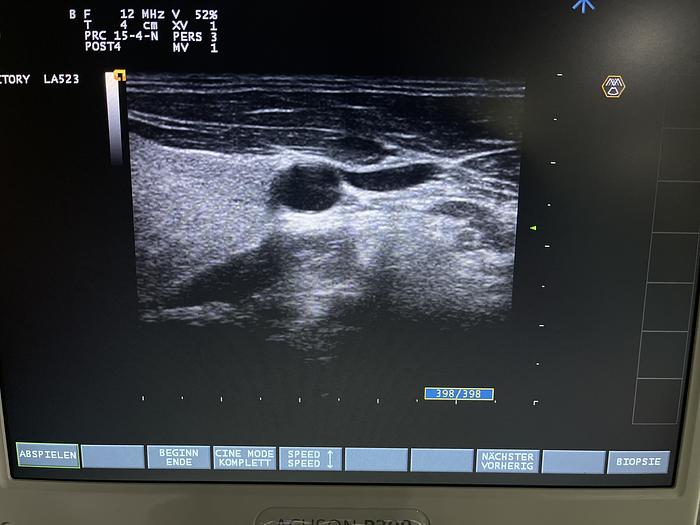 Used Esaote LA523 Linear Ultraschallsonde 