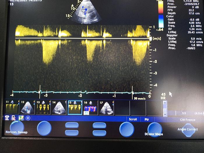 Gebraucht GE Vivid S5 Ultraschallgerät