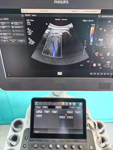 Gebraucht Philips V6-2  3D/4D  Volumen Ultraschallsonde